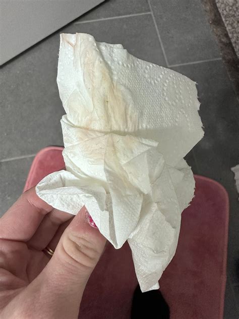 Bloody Discharge Yeast Infection