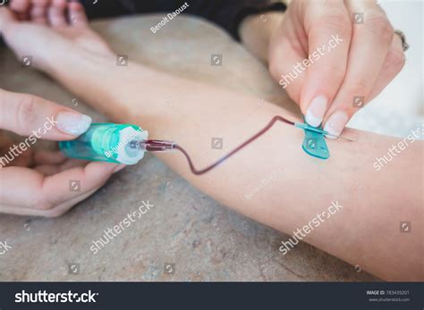 How To Draw Blood With Butterfly Needle