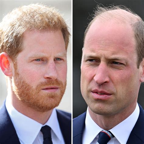 Did Donald Trump Get Hair Transplant Surgery Or Does He Wear A Wig? A ...