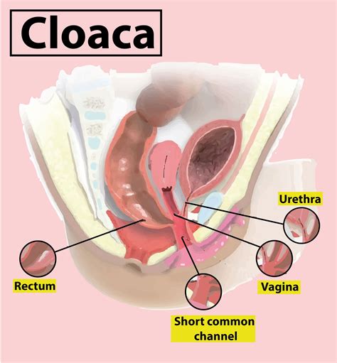 Cloaca is(a)Common aperture for digestive and urinary systems(b)Common aperture for digestive ...