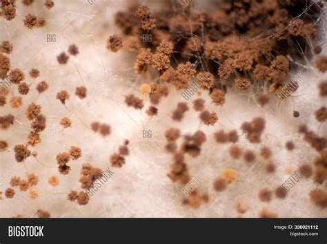 Mold Under Microscope