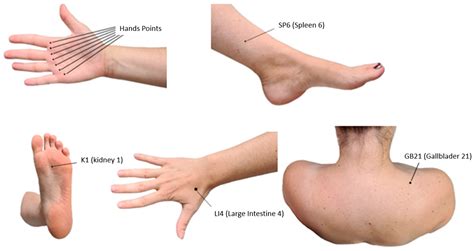 Effects of Acupressure on Maternal and Neonatal Obstetric Outcomes ...
