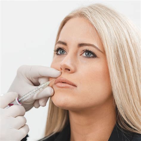 Lip Augmentation Houston - Lip Enhancement River Oaks TX