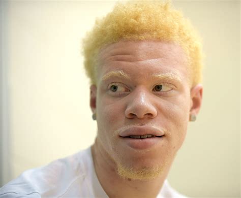 Black Albino Model