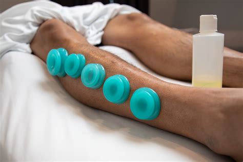 Cupping Massage in Spanish Fork | Massage in Eagle Mountain