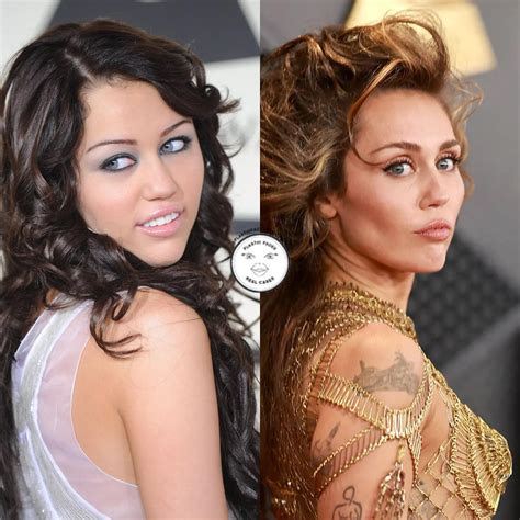 Miley Cyrus Plastic Surgery