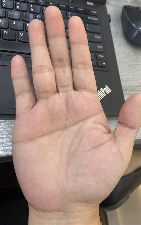 Single Palmar Crease on both palms - anything unusual? Wondering about ...