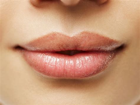Cold Sore Or Pimple Corner Of Mouth