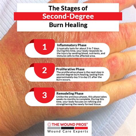 The Stages of Second-Degree Burn Healing 🩹Inflammatory Phase The first ...