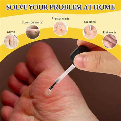 ENERIDEA Líquido removedor de verrugas – Tratamiento eficaz para verrugas plantares, planas y ...