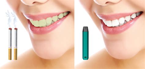 Does Vaping Spread Germs at Bobby Mosca blog