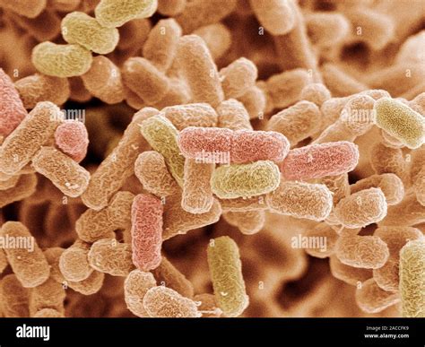E. coli bacteria. Coloured scanning electron micrograph (SEM) of Escherichia coli bacteria ...