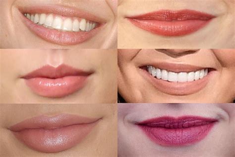 Different Types Of Lips Shapes