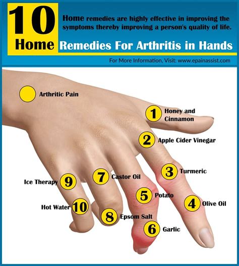 Arthritis Arthritis Hands, Arthritis Relief, Types Of Arthritis, Arthritis Symptoms, Arthritis ...