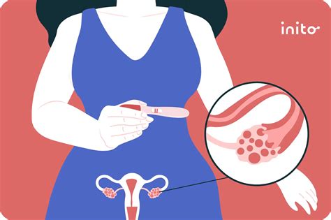 Is Having Sex Everyday Bad When Trying to Conceive? - Inito