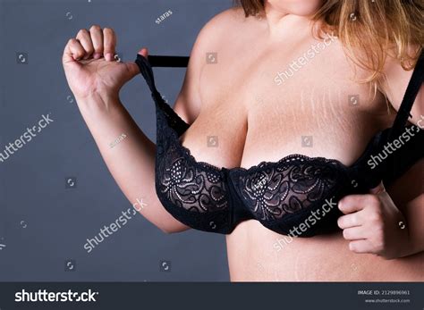 Stretch Marks On Large Natural Breasts Stock Photo 2129896961 ...