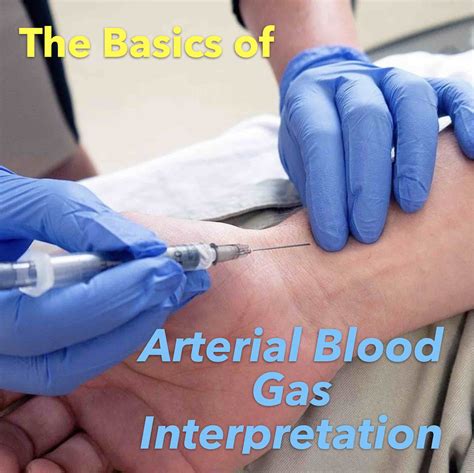 Arterial Blood Gas