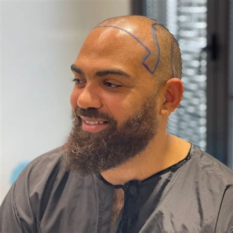 Head Shaved With Beard