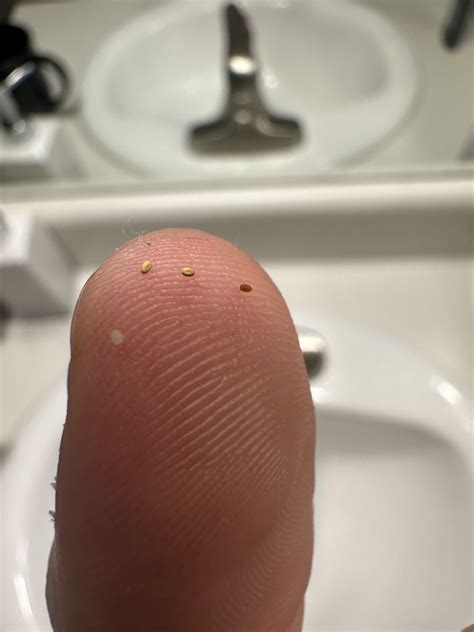 Is this bed bug poop? I keep finding these on my bedding in a mass ...