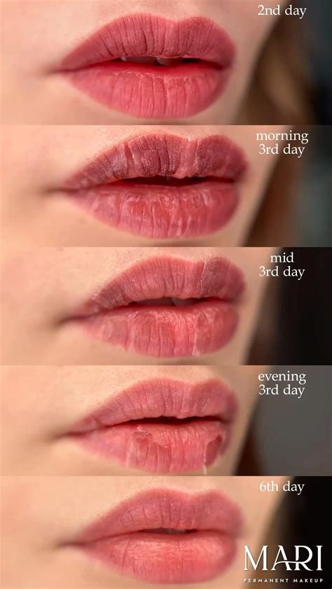 Permanent Lip Color Healing Process A Nurses Touch Skin Care Spa