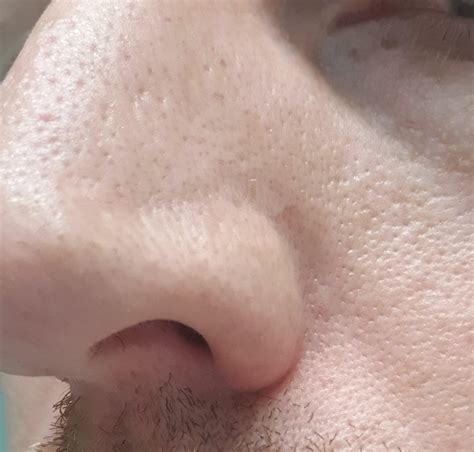 How to reduce pore size? : r/AusSkincare