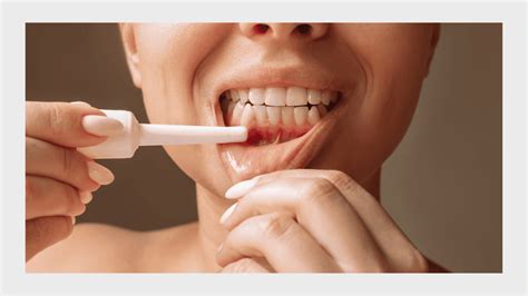 How to Stop Receding Gums: Prevention Tips from Dentists