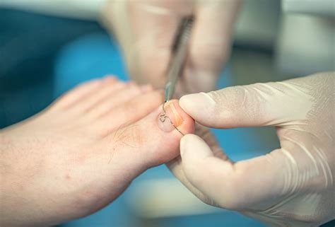 Best podiatrist in my area | Podiatrists Housecalls Chicago