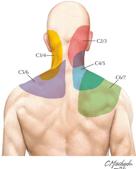 Cervical Spine - Clinical Tree