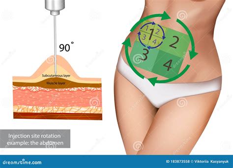 Injection Into Buttocks Line Icon, Injections Concept, Intramuscular ...