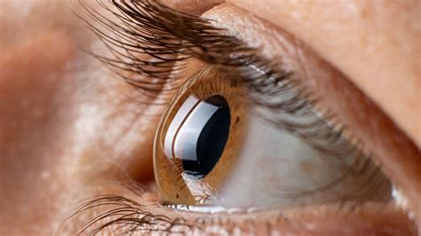 United Healthcare Vision