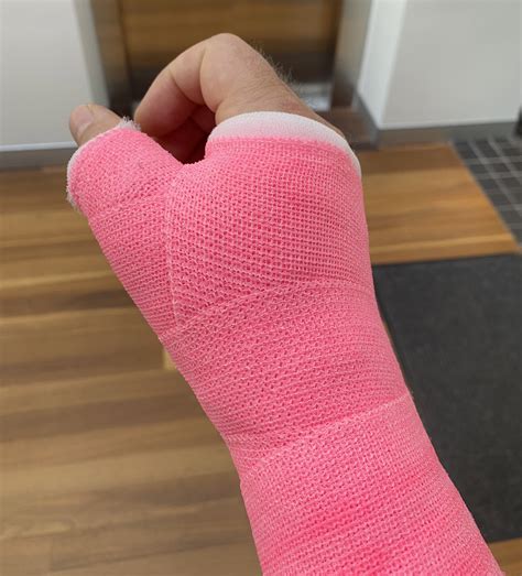 Broken Wrist Cast Pink