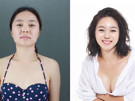 South Korea is the plastic surgery capital of the world | 15 Minute...