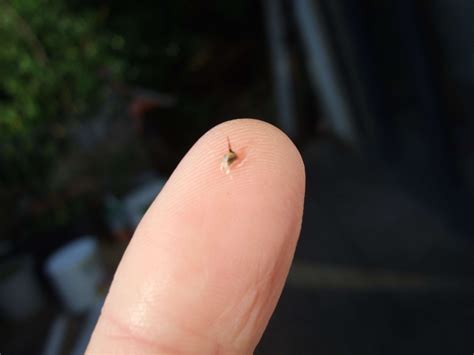 Bee stings – numbers 2 to 15 | Talking With Bees