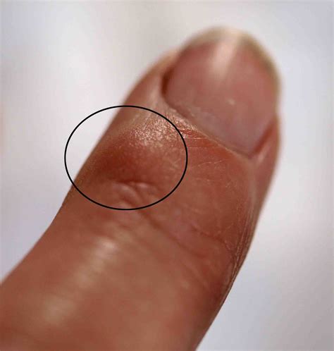 Why Does The Bumps On My Nipples Hurt - Design Talk