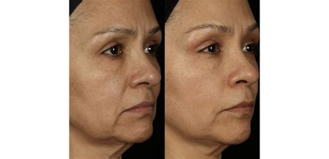 Results | Cellexia Labs