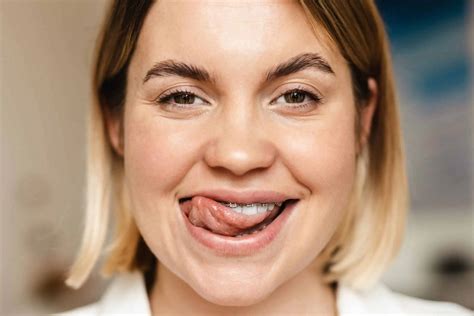 Orthodontics can help to Stop Tongue Thrusting? - Dental Health Clinic