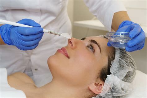 Is a Deep Chemical Peel Right for You? Find Out Here