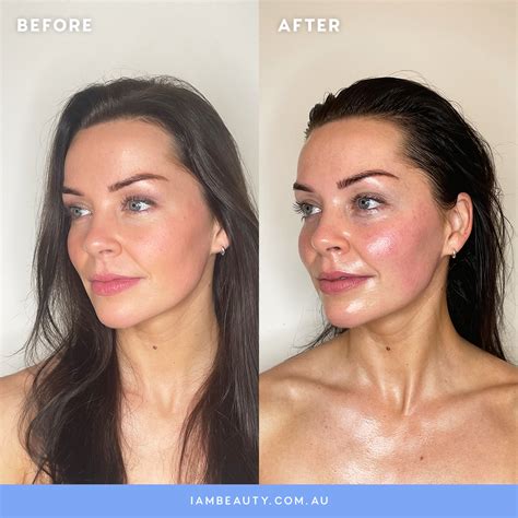 Lymphatic & Buccal Facial Massage - Before and After photos