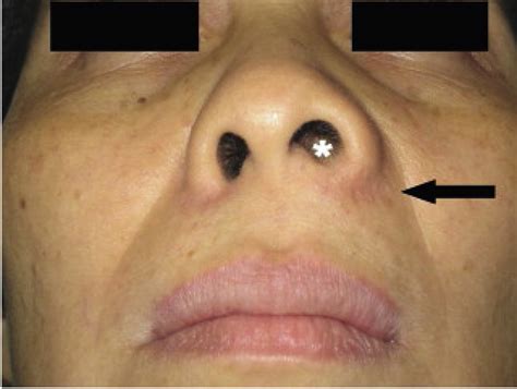Nonodontogenic Cysts - Dental Clinics