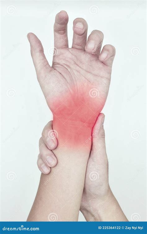 Inflammation Of Wrist Joint And Tendon. Concept Of Joint Pain And ...