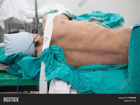 Left Lateral Decubitus Image & Photo (Free Trial) | Bigstock