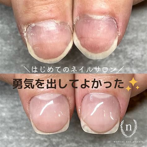 3週間で自爪ぐんぐん成長💅🏻 | sukru natural beauty salon (シュクルナチュラルビューティサロン) | 広島 ...