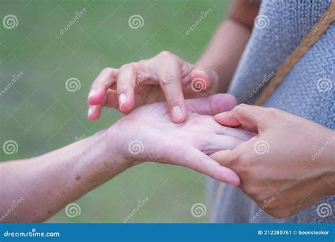 A Young Woman`s Hand is Touching a Lump of Flesh Up the Middle of the Palm of a Senior Woman ...