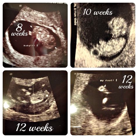 Pregnancy Update - Baby at 12 weeks! - Our Knight Life