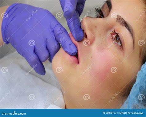 How To Massage Lips After Filler? - GA Fashion