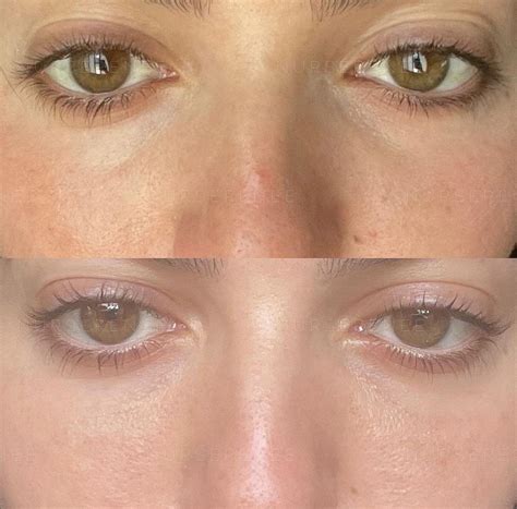 Sydney’s leading cosmetic clinic, based in Drummoyne for over 20 years ...