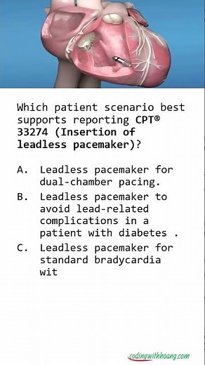 Leadless Pacemaker Coding