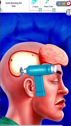 Simple Brain Surgery in real surgery simulator game ☠️🍷☠️