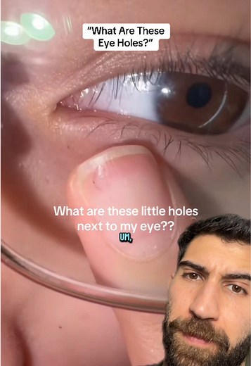 Understanding the Punctum: Key to Eye Health Explained