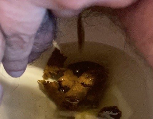 Lots of Logs, Big and Small